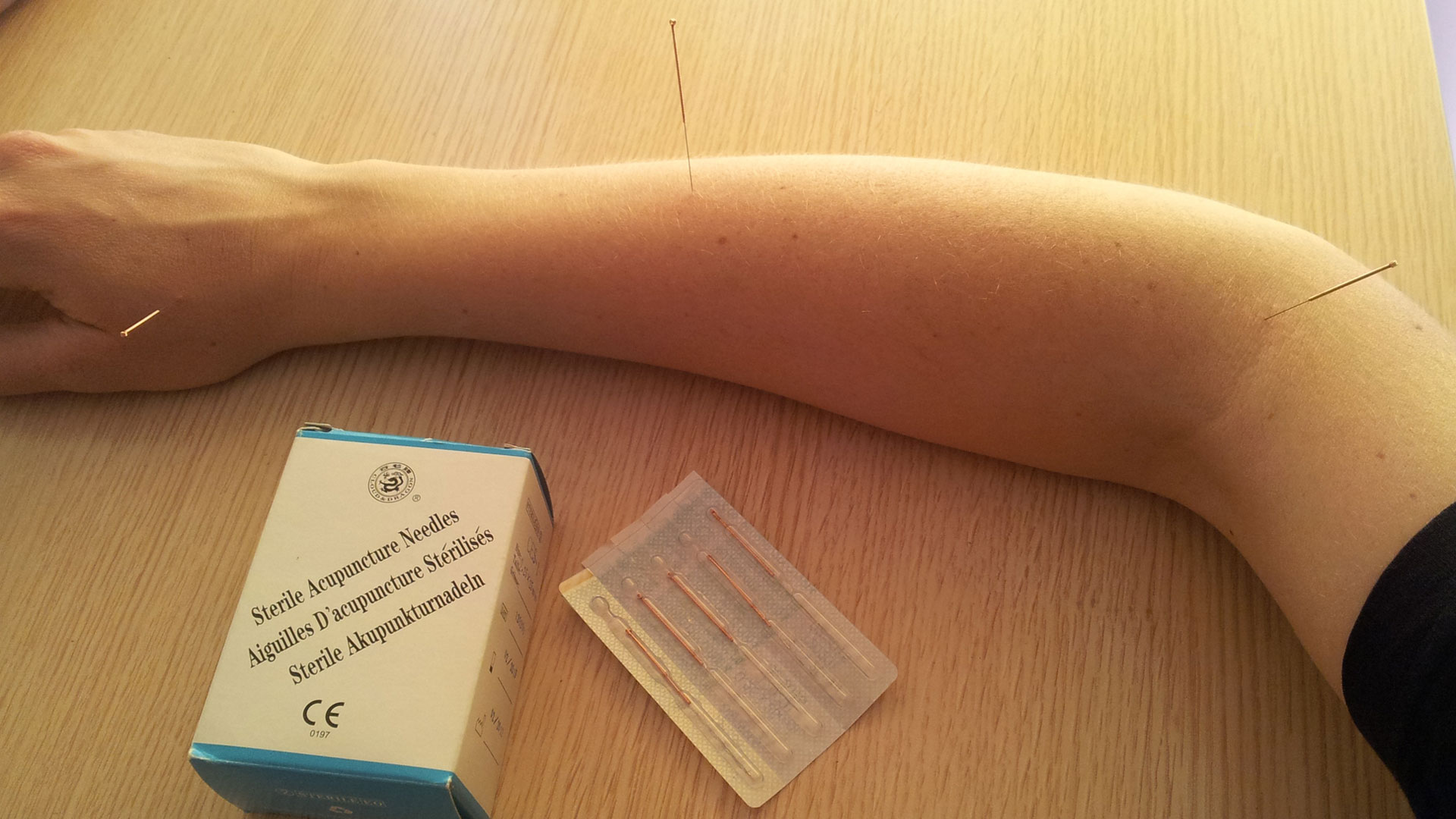 acupuncture-banner-bg